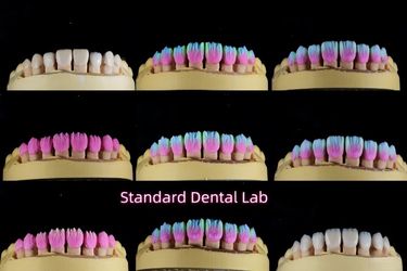 Standard Dental Lab Co., Limited γραμμή παραγωγής του κατασκευαστή