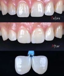 Standard Dental Lab Co., Limited γραμμή παραγωγής του κατασκευαστή