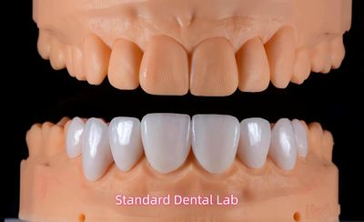 Standard Dental Lab Co., Limited γραμμή παραγωγής του κατασκευαστή