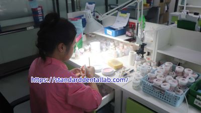 Standard Dental Lab Co., Limited γραμμή παραγωγής του κατασκευαστή