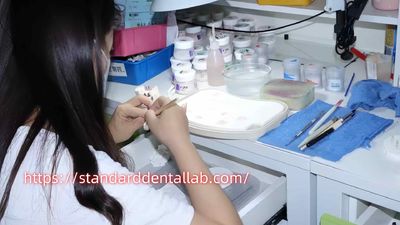 Standard Dental Lab Co., Limited γραμμή παραγωγής του κατασκευαστή