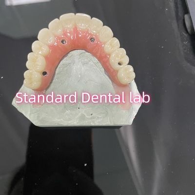 Αγορά Όλο σε τέσσερα έξι Ivoclar Zirconia Implant Bridge Τιτανίου μπάρα με ροζ τσίχλα πορσελάνη σε απευθείας σύνδεση κατασκευή