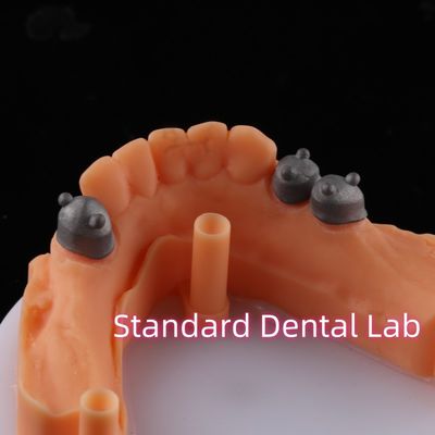 Αγορά Διάταξη του τηλεσκοπίου Πρωτογενής Δευτερογενής Πρωτογενής Μη πολύτιμη NP σε απευθείας σύνδεση κατασκευή