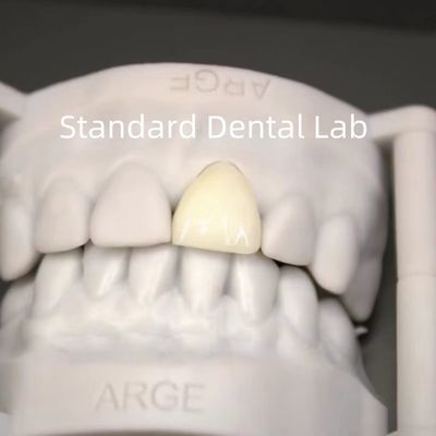 Αγορά Ψηφιακό CAD CAM Δοντιατρικά Εργαστηριακά Στέμματα Διαφανή Στέμματα Ζιρκόνια Στέμματα σε απευθείας σύνδεση κατασκευή
