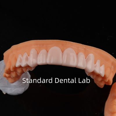 Αγορά Υψηλής αισθητικής οδοντιατρική Snap On Smile Standard οδοντιατρικό εργαστήριο σε απευθείας σύνδεση κατασκευή
