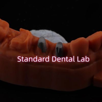 Αγορά Μεταλλικό Post Core Crown CAD CAM Πορσελάνη / Ζιρκόνια Αντιμετώπιση Full Zircnonia Bruxier Crown σε απευθείας σύνδεση κατασκευή
