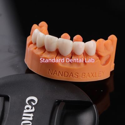 Αγορά Η άνεση και η λειτουργία με το ψηφιακό CAD CAM οδοντιατρικό εργαστήριο Διαφανής στρωμένη γέφυρα από ζιρκόνια σε απευθείας σύνδεση κατασκευή