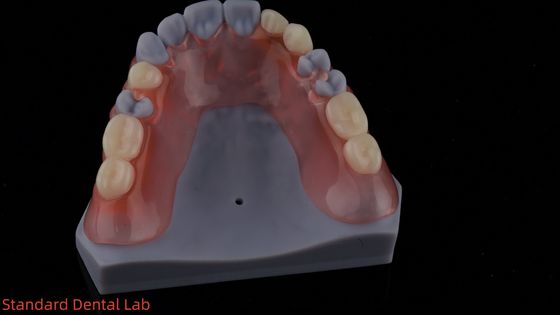 Αγορά 3D εκτύπωση μοντέλο υψηλής αισθητικής οδοντιατρική TCS Valplast ευέλικτες μερικές οδοντοστοιχίες οδοντιατρικό εργαστήριο σε απευθείας σύνδεση κατασκευή