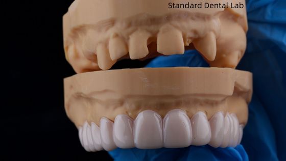 Αγορά Υψηλή αισθητική οδοντιατρική Snap On Smile Standard οδοντιατρικό εργαστήριο αφαιρούμενη οδοντιατρική συσκευή σε απευθείας σύνδεση κατασκευή