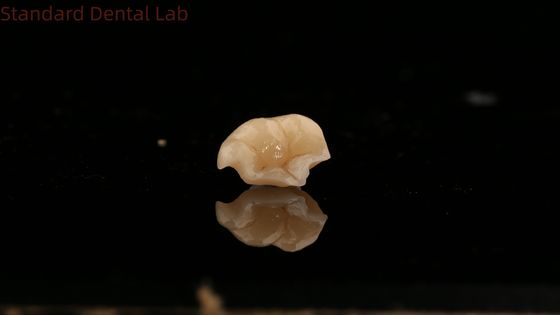 Αγορά Δυνατότητα Emax Κεραμική Κρόουνα Δοντιατρική Onlay με εξαιρετική αντοχή στα λεκέδες Κίνα Δοντιατρικό Εργαστήριο σε απευθείας σύνδεση κατασκευή