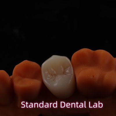 Υψηλή αισθητική BruxZir Full Contour Zirconia Crown PFZ γέφυρα