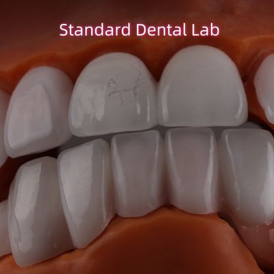 Λιθίου Δικικιλικό στρώμα Ivoclar Emax Zirconia Laminate Veneers Διαφανή OEM ODM