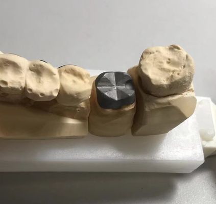 ISO FDA CE Χονδρική μεταλλική στήλη και πυρήνας στέμματος PFM Καλή εφαρμογή