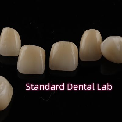 Οδοντιατρικά στερεά στρωμένα στεφάνια από ζιρκόνια