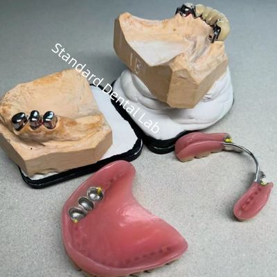 Υψηλή αισθητική CAD CAM Δόντι μερική προσάρτηση οδοντοστοιχίας Αντικατάσταση Τυποποιημένο οδοντιατρικό εργαστήριο
