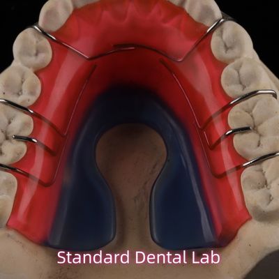 Αφαίρετη οδοντιατρική ορθοδοντική συσκευή Hawley Retainer