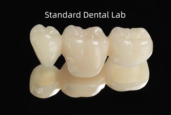 CAD CAM Κενό PMMA Προσωρινή οδοντιατρική προσωρινή γέφυρα