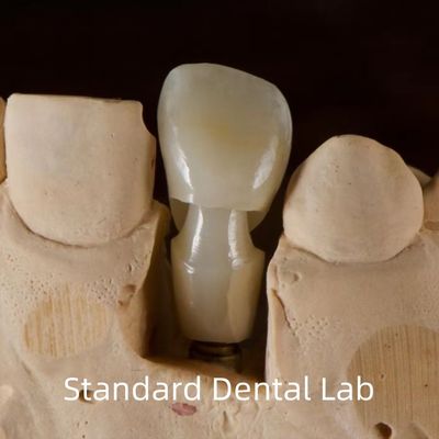 Οδοντιατρικό εμφύτευμα Tibase Zirconia Abutment Τιτάνιο ακρίβεια Προσαρμοσμένη