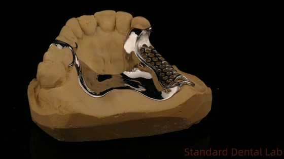 Υψηλής αντοχής 3D εκτυπωμένο χυτοπλαίσιο COCR μερικές οδοντοστοιχίες Χρωμικό Κοβάλτιο χυτομεταλλικό πλαίσιο