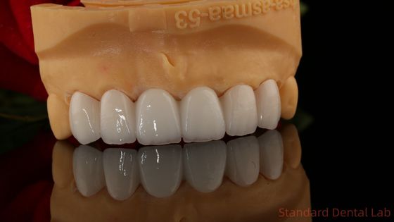 Πλήρη Εγκάρδια Ζιρκόνια στέμμα διαφανές 3D PRO Χωρίς Πορσελάνη Επισκευή Τυποποιημένο Οδοντικό Εργαστήριο