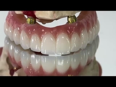 Οδοντιατρική ΟΛΟΣ ΟΝ X εμφύτευση PFM Crown Titanium Fixed Hybrid Denture