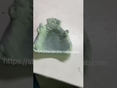 Γρήγορο και χύτευτο πλαίσιο Co-Cr μεταλλικό σύστημα μερικής οδοντοστοιχίας για τους οδοντίατρους