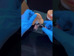 Καθαρό πλαίσιο Ακρυλικό μέταλλο Πλαίσιο μερικής οδοντοστοιχίας Υψηλή αισθητική Κίνα οδοντιατρικό εργαστήριο