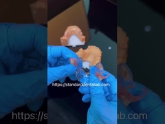 FDA Κοβάλτιο Χρωμικό Υψηλή αισθητική διαφανής πλαίσιο μερική