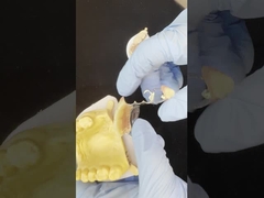 Προσαρμόσιμο Cobalt Chrome Cast Framework με πολύ καλά αυτοκόλλητα