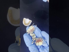 Προσαρμόσιμο Cobalt Chrome Cast Framework με πολύ καλά αυτοκόλλητα