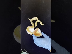 Dentsply Lucitone 199 Ακρυλική οδοντοστοιχία για πλήρη φυσική εμφάνιση