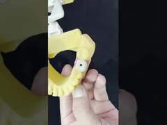 Πορσελάνη All On Four Γέφυρα Ζιρκόνια υψηλής αισθητικής οδοντιατρικά εμφυτεύματα