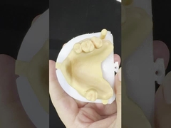 Μεταλλικά κράματα μερικώς Κοβάλτιο Χρωμικές οδοντοστοιχίες Ivoclar Scheftner άνετο μεταλλικό πλαίσιο