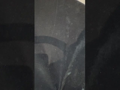 Προσωπικές οδοντοστοιχίες με στήριξη από εμφυτεύματα τιτανίου