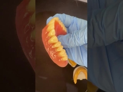 Πλήρης άνω και κατώτερης επιφάνειας ακρυλικών μερικών οδοντοστοιχείων Ivoclar δόντια ροζ τσίχλα